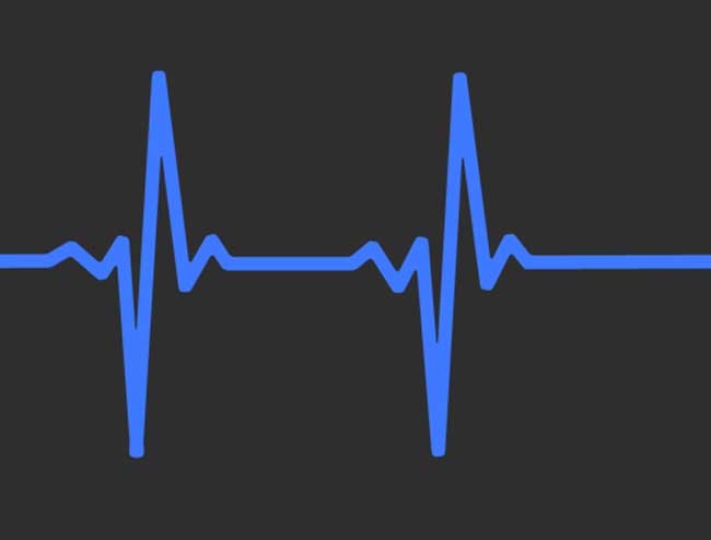 escape room Cáceres La delgada línea azul